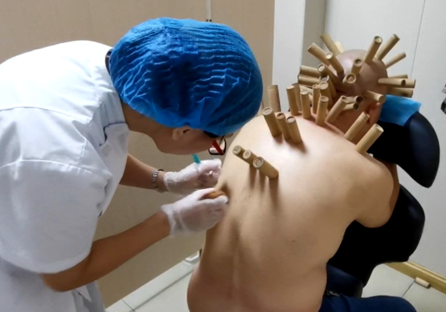 可以節(jié)約醫(yī)保開(kāi)支